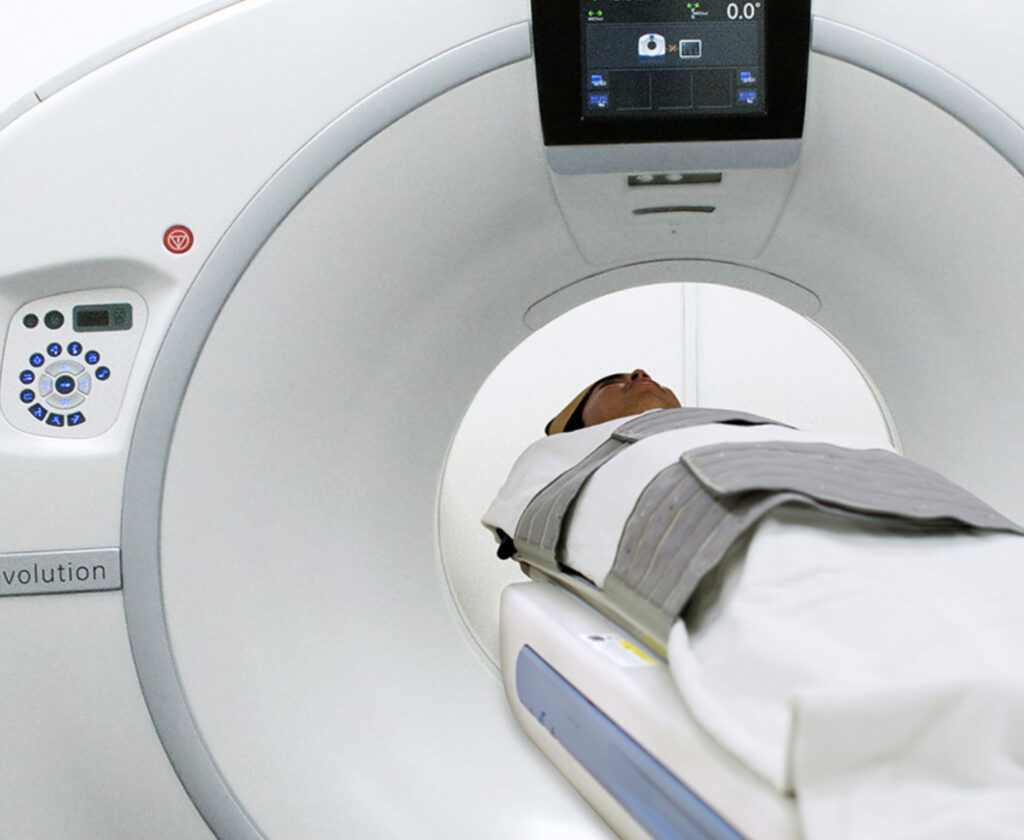 Screening for Lung Cancer